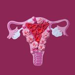 PCOS krijgt eindelijk een nieuwe naam en dit is waarom