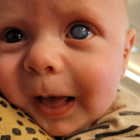 Illustratie bij: Kinderglaucoom: 5x dit wist jij nog niet over de ernstige oogziekte