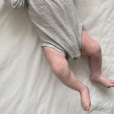 Illustratie bij: Tussen wel en wee: ‘Door de plotselinge onderbreking, komt hij vast te zitten’