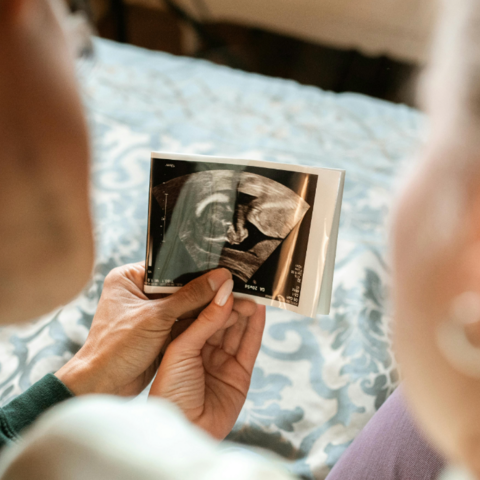 Illustratie bij: Ja echt: zo kun je zelf op de echo het geslacht van je baby al zien