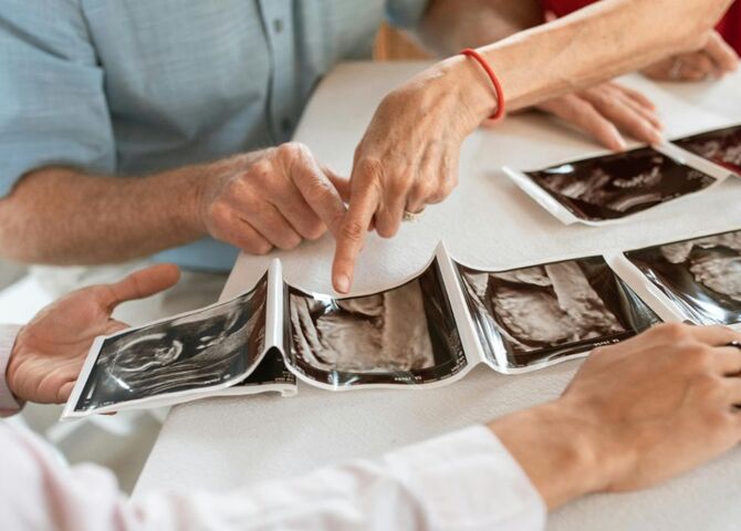 Schoonmoeder wil geen tweede kleindochter