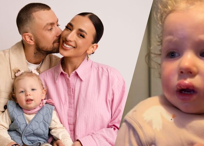 Illustratie bij: René Watzema over heftige allergieën van dochter Noré (2): ‘In Spanje ging het echt helemaal mis’