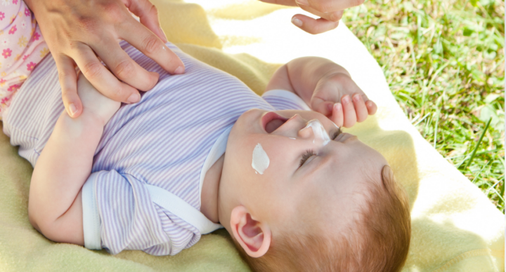 kinderzonnebrand