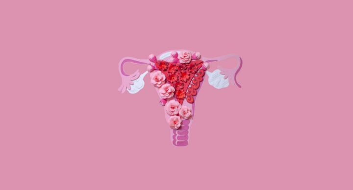 endometriose