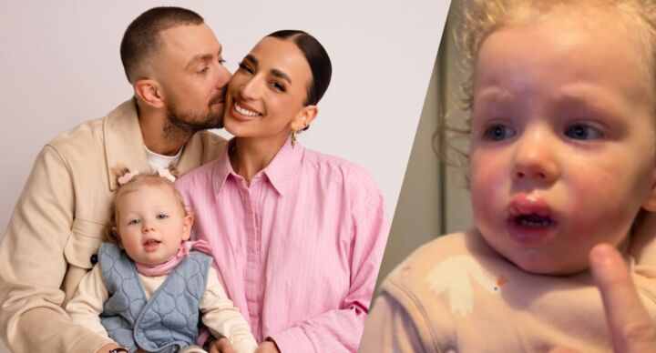 Illustratie bij: René Watzema over heftige allergieën van dochter Noré (2): ‘In Spanje ging het echt helemaal mis’