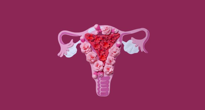 pcos