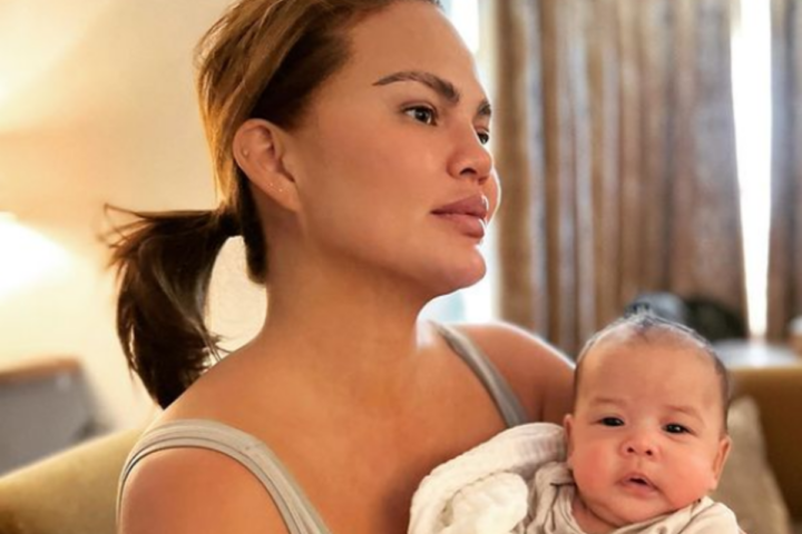 Illustratie bij: ‘Hangende borsten’ en ‘levenslange littekens’: Chrissy Teigen omarmt postpartum lichaam